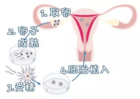 武汉捐卵医院